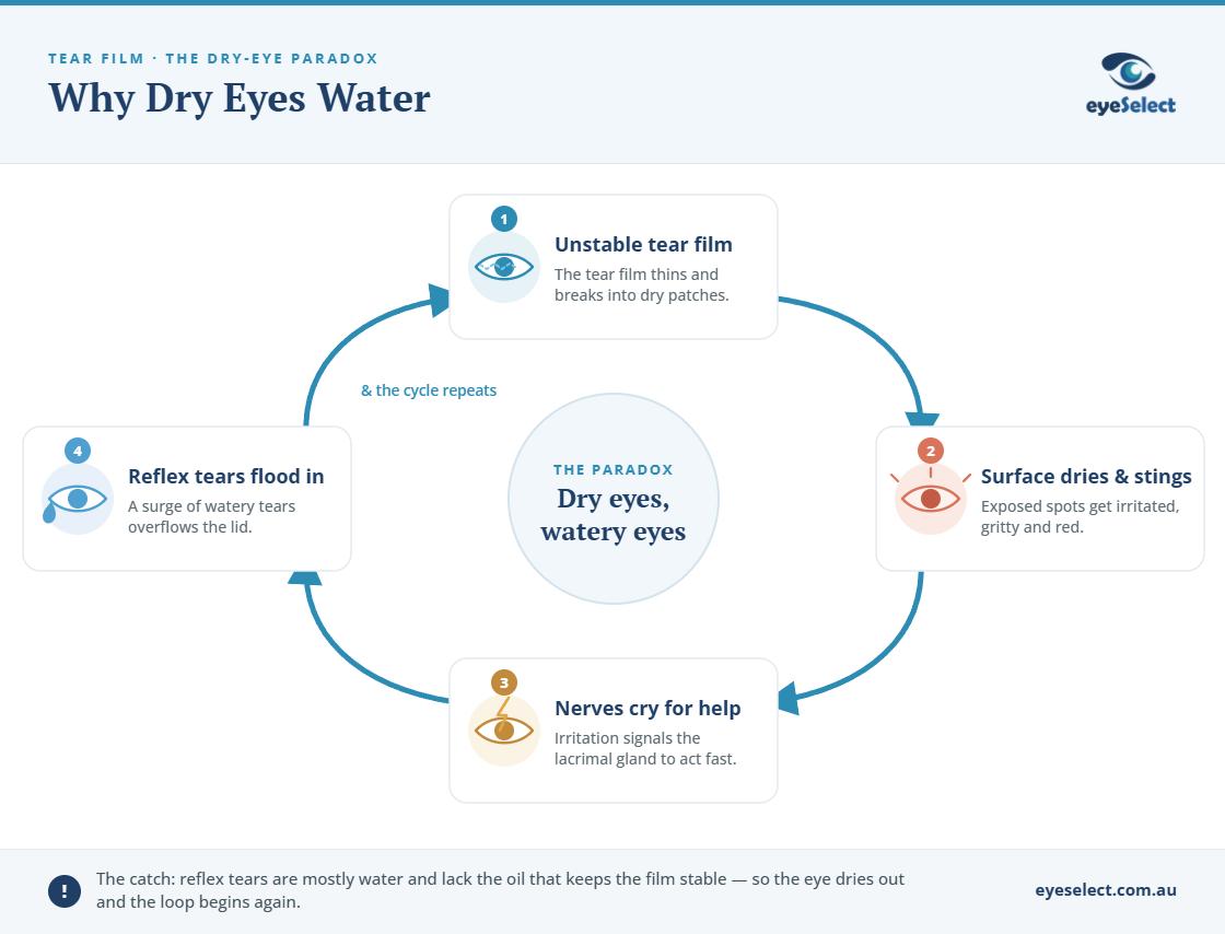 Explainer showing how a dry, unstable tear film irritates the eye and triggers watery reflex tears that overflow.