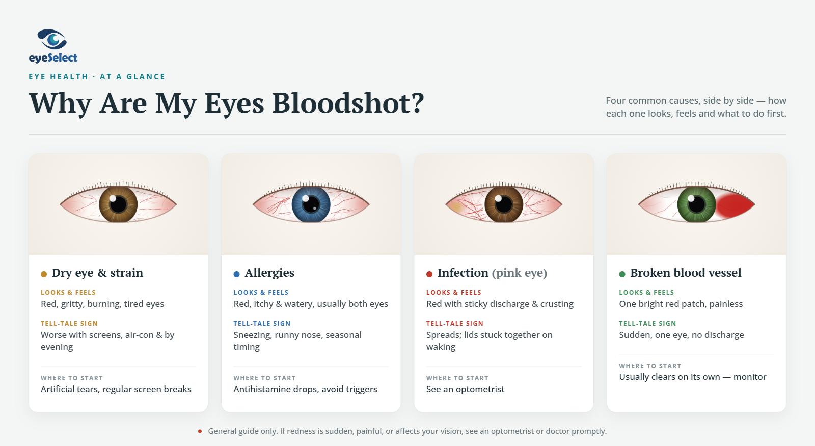 Infographic showing four causes of bloodshot eyes side by side with their key symptoms.