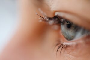 watery eyes