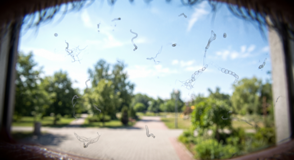 Eye Floaters: What They Are, What Causes Them and When to See an Optometrist